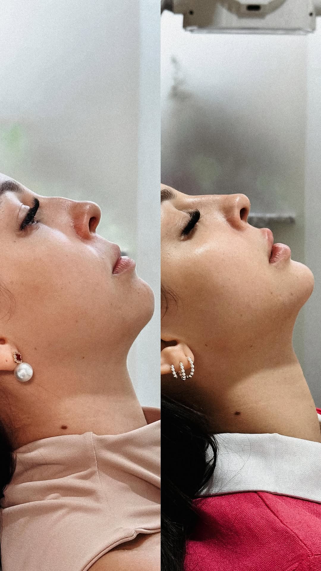 Antes e depois — caso 2